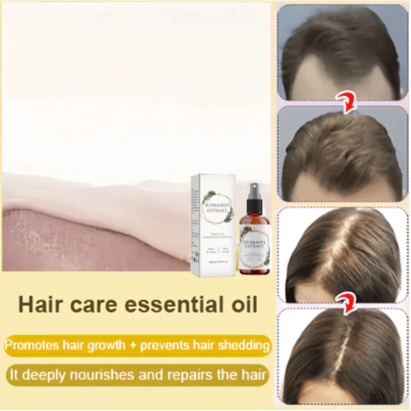 Hair Care Rosemary Oil Hair Root Strengthening AntiHair Loss Oil Camouflage Hair Care Oil