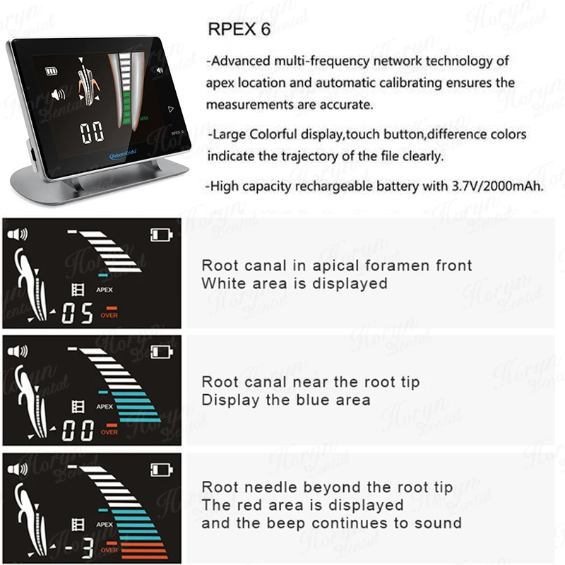 Цветной эндододонтический Апекслокатор корневого канала, 4,5 дюйма, ЖК-дисплей, беспроводное оборудование для обработки эндодонтического корневого канала, стоматологическое оборудование