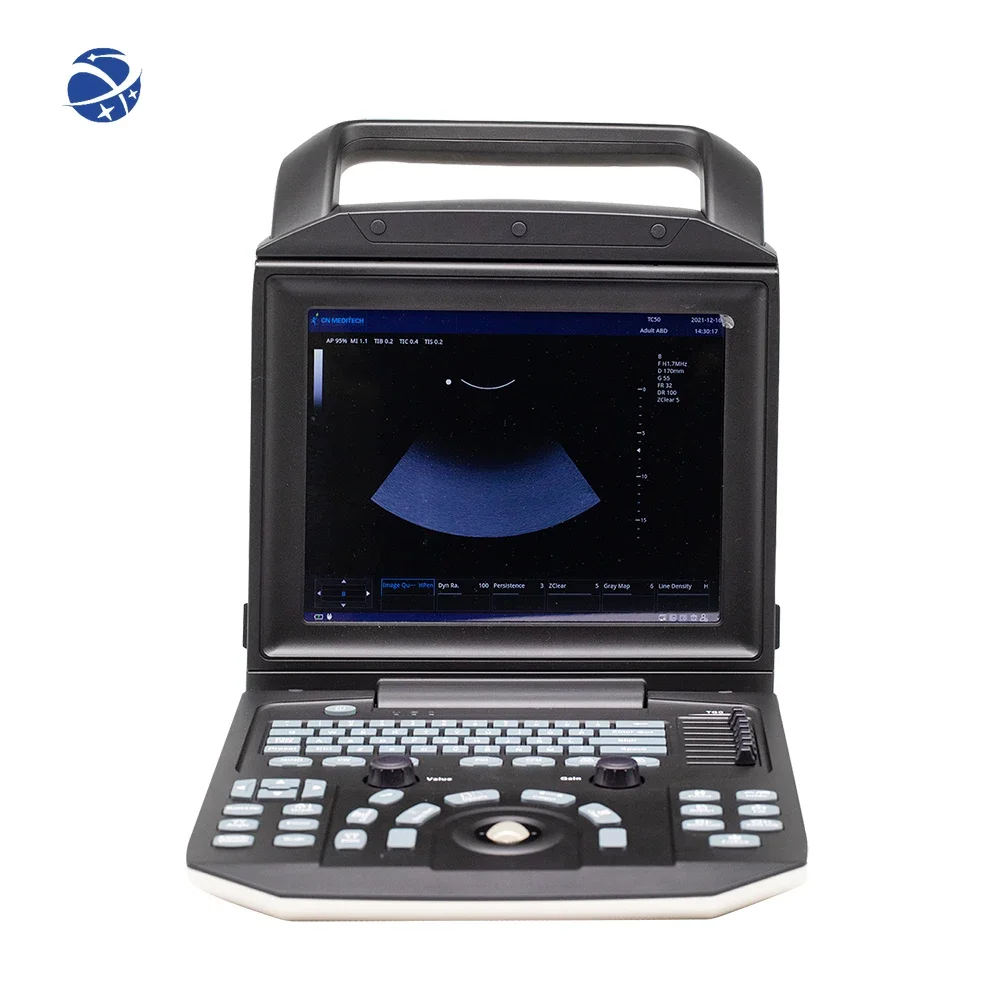 Portable Medical Ultrasound Instrument Medical Color Doppler Ultrasound 3D 4D Color Doppler Laptop Ultrasound