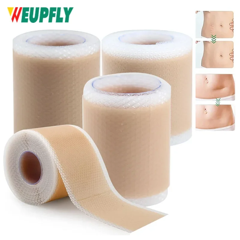 1 Roll Professional Silicone Scar Sheets Scars Treatment - Reusable Silicone Scar Strips Type for Keloid, Surgery, Burn, Acne et