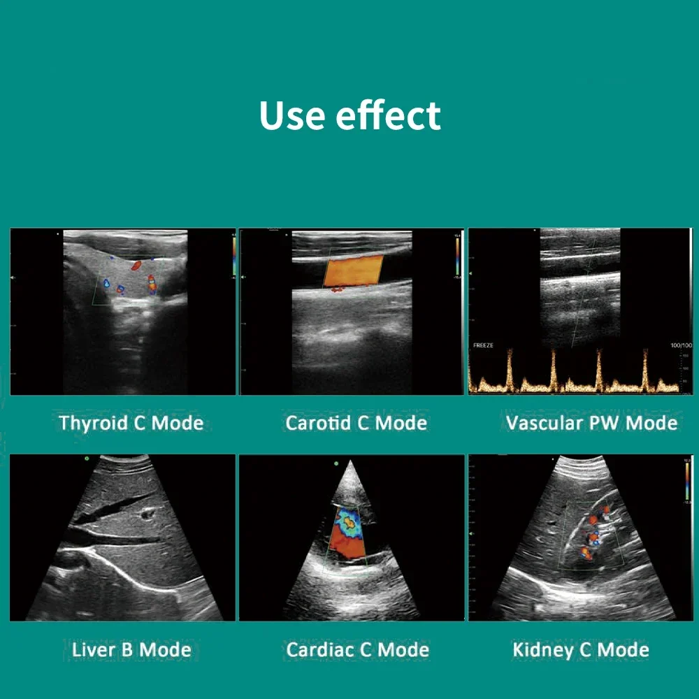 3 in 1 128E Wireless Ultrasound Scanner Color Doppler Portable Convex Linear Cardiac Probe C10RL