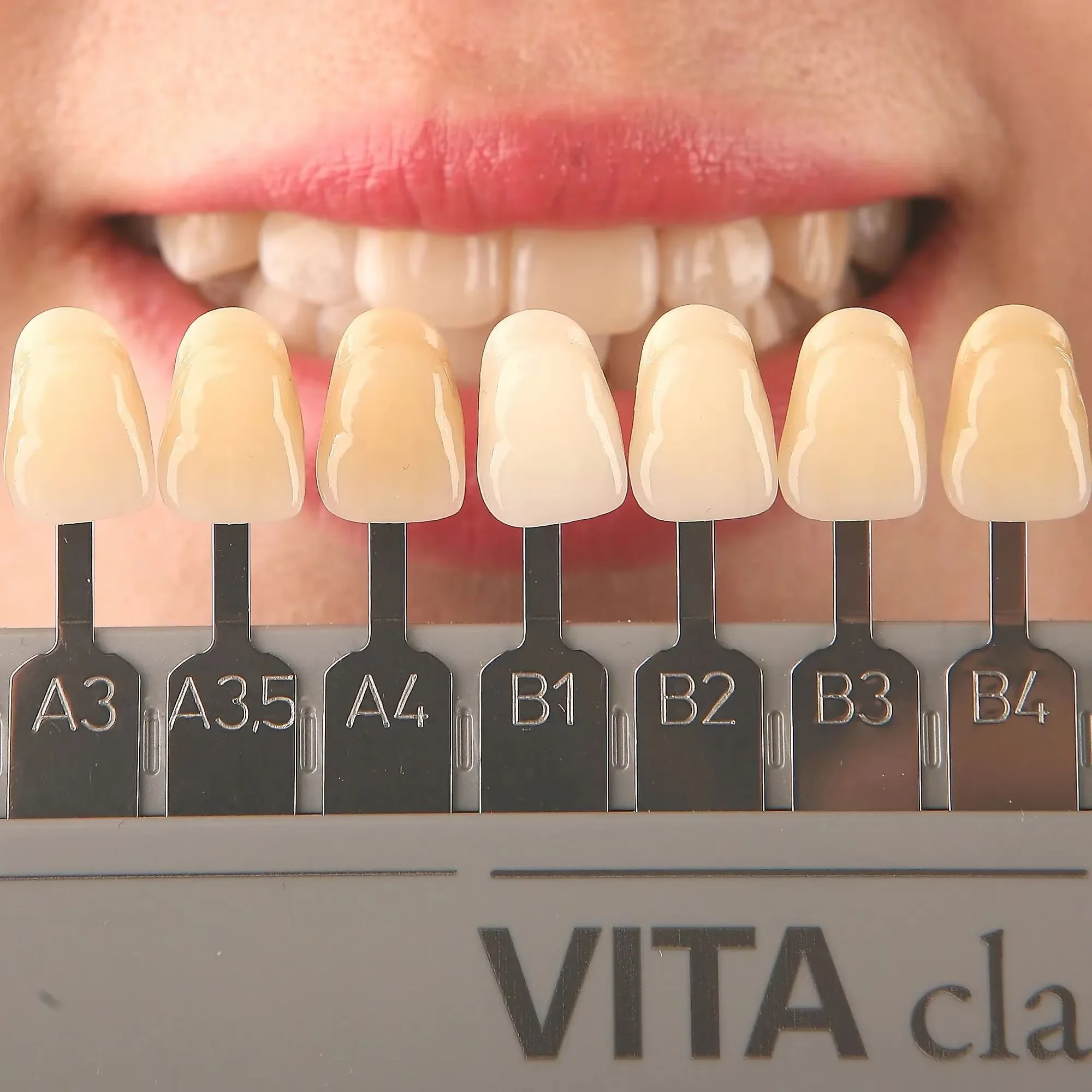 VITA 16 Colors Dental Teeth Sh - Teeth Whitening Shade Guide review and price