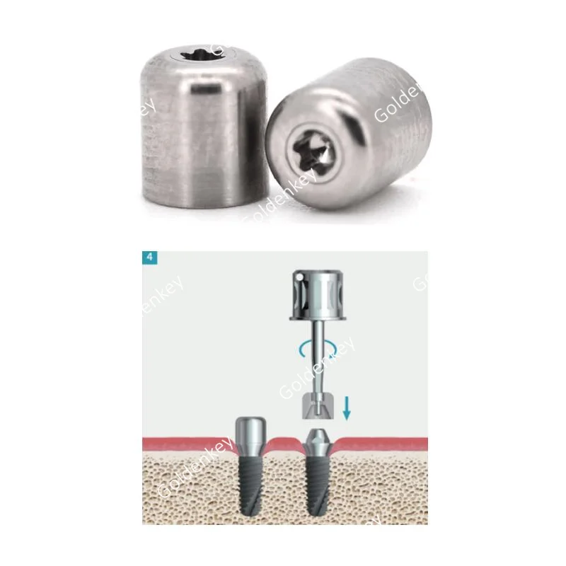 RCΦ4.6 Dental Protective Cap Multi Unit For Abutment Cover Screw Fits Straumann ITI Protection