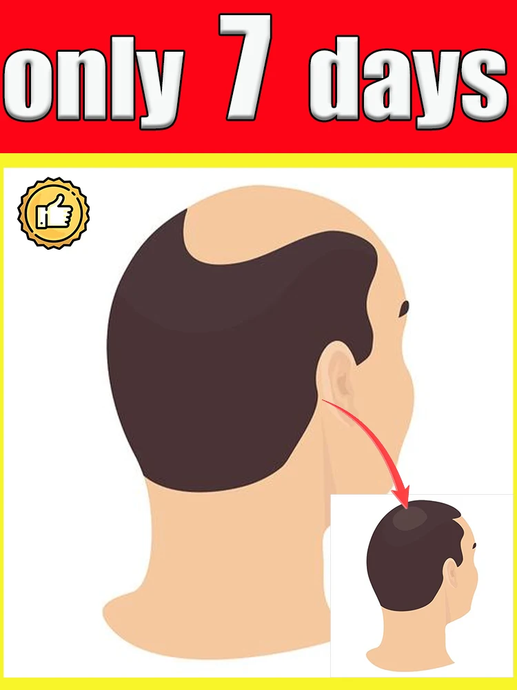 

Holiday gift applicator, give it to your bald friend to promote hair follicle growth