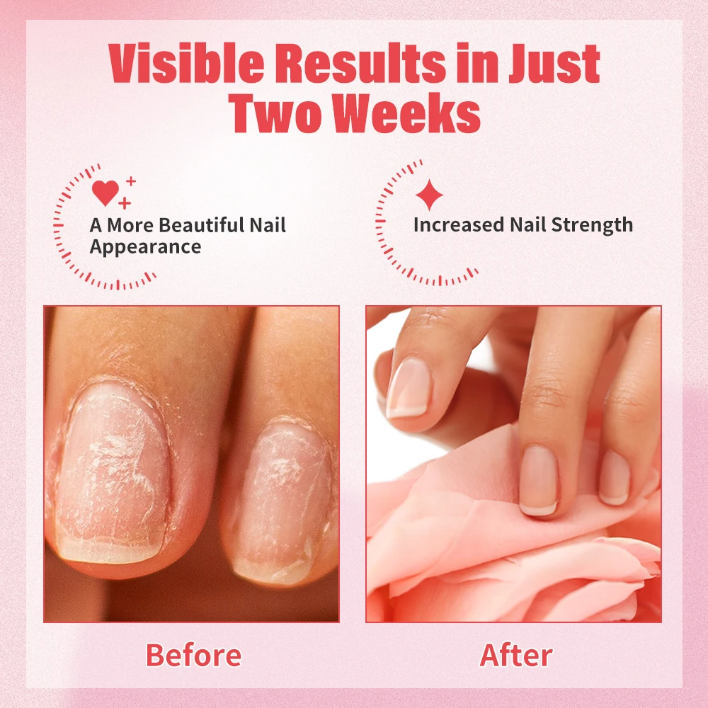 Aceite para fortalecimiento de uñas duro como pezuña, aceite acondicionador para cutículas, detiene divide, patatas fritas, grietas y fortalece las uñas