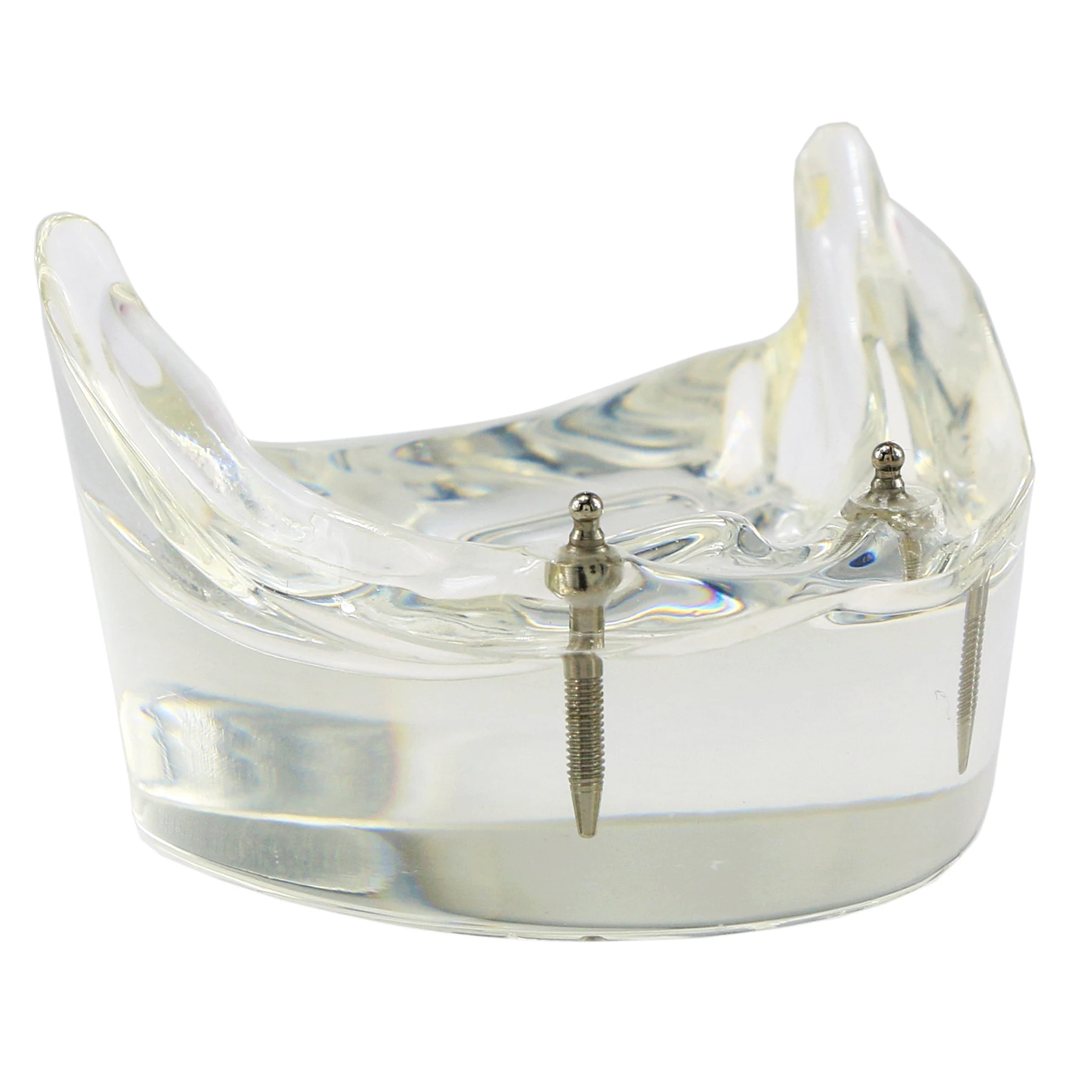 Dental Model M6002 Overdenture Inferior 2 Implants Restroration Study Clear Acrylic Lower jaw Base Allows View of Implants