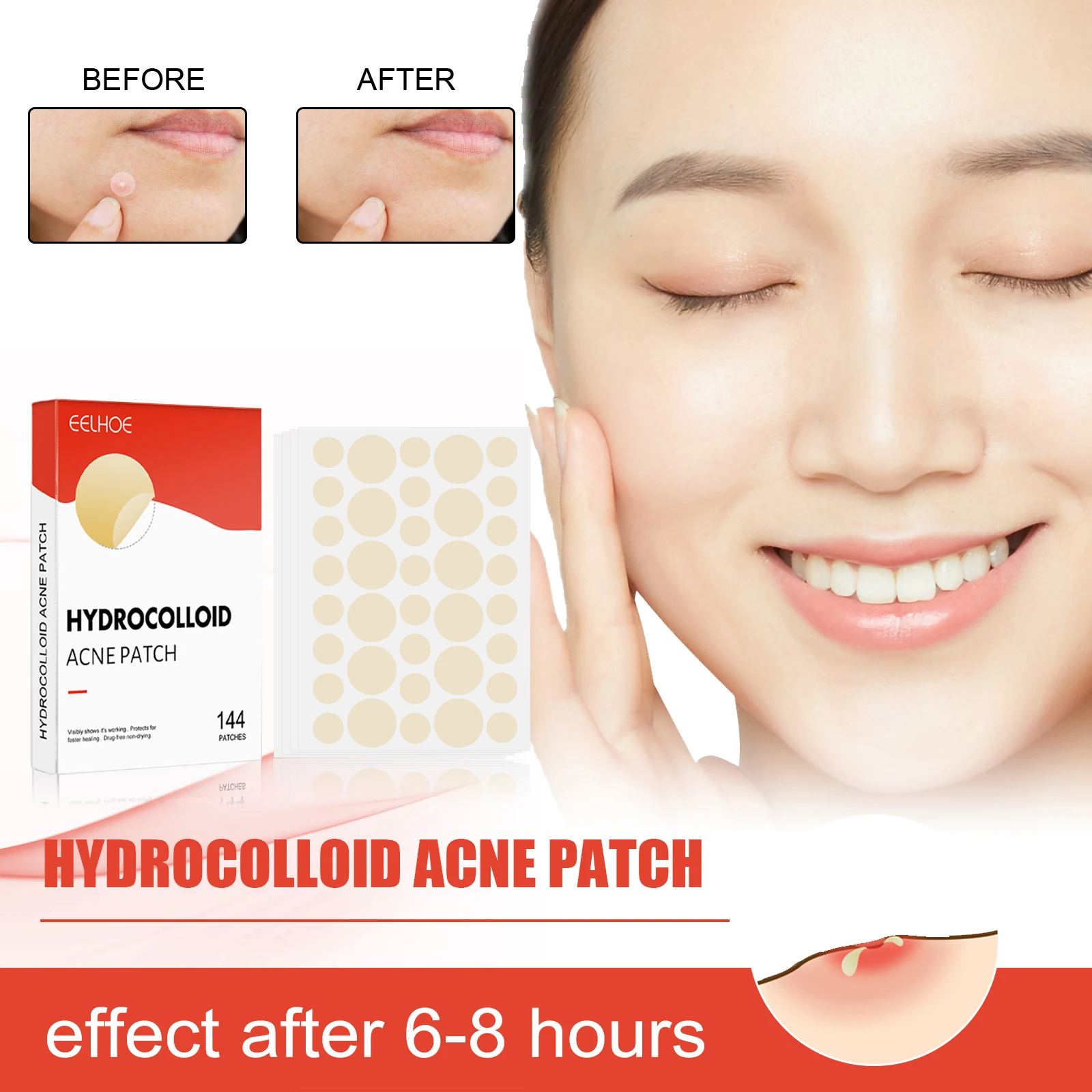 144pcs Face Acne Patch Invisible Skin Care Hydrocolloid Pimple Acne Patches Professional Absorbing Spot Sticker Covering Acne