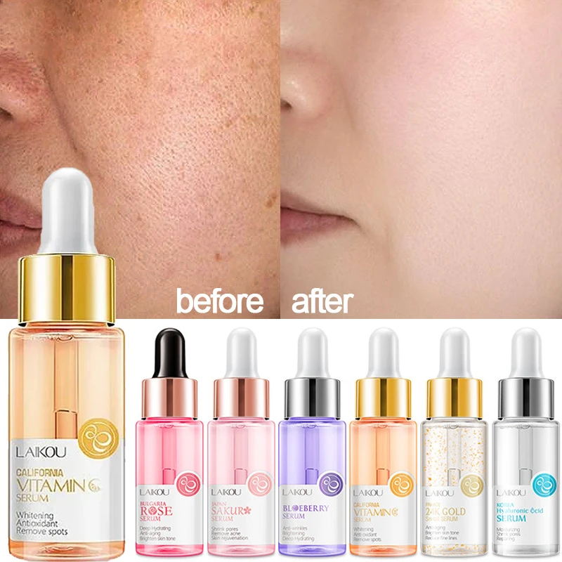 Sérum Facial Hidratante 15ml com Ouro, Caracol e Vitamina C, Essência Iluminadora e Hidratante com Ácido Hialurônico Sakura para Cuidados com a Pele d