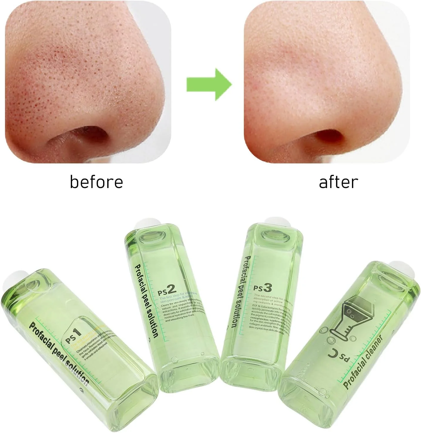 Professional Hydra Dermabrasion Solution for Face - Gentle Cleansing Serum with Hydrating Formula for Skin Refreshment