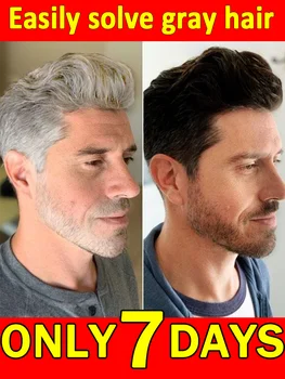 ยาฆ่าผมขาว แก้ปัญหาผมหงอกได้อย่างสมบูรณ์แบบและคืนสีผมตามธรรมชาติ