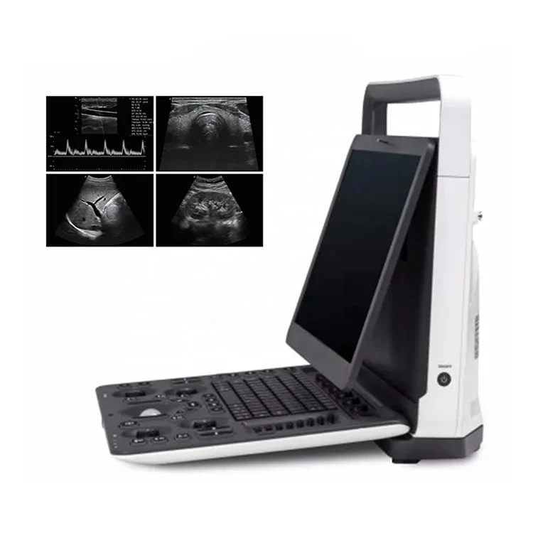 Medical Ultrasound Instruments ecografia portatil Sonoscape E2 Ultrasound Portable Color Doppler Ultrasound Machine