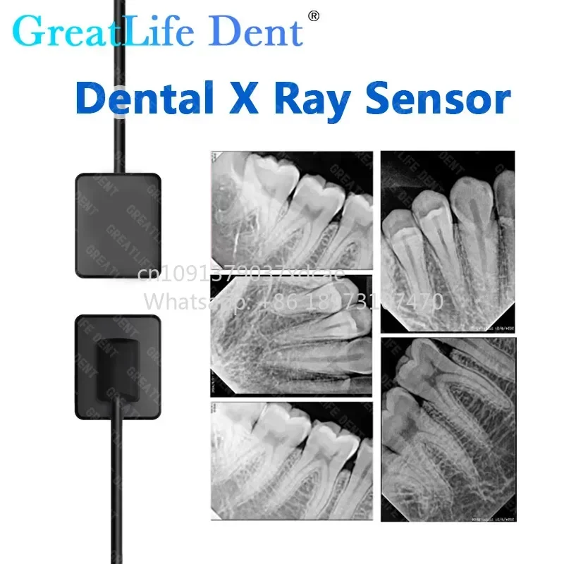 2026 NEW GreatLife Dent 2 Year Warranty Mexico EU IT In Stock Portable . X Ray Unit Digital RVG AI Sensor Software With Twa