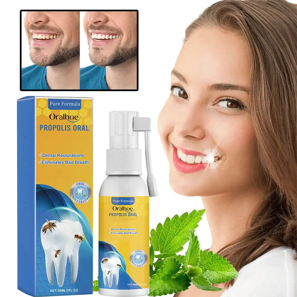 30ml Propolis Oral Instant Treatment Spray Oral Treatment Breath Keeps Health Bad Mouth Clean Effectively Oral Refresh Care