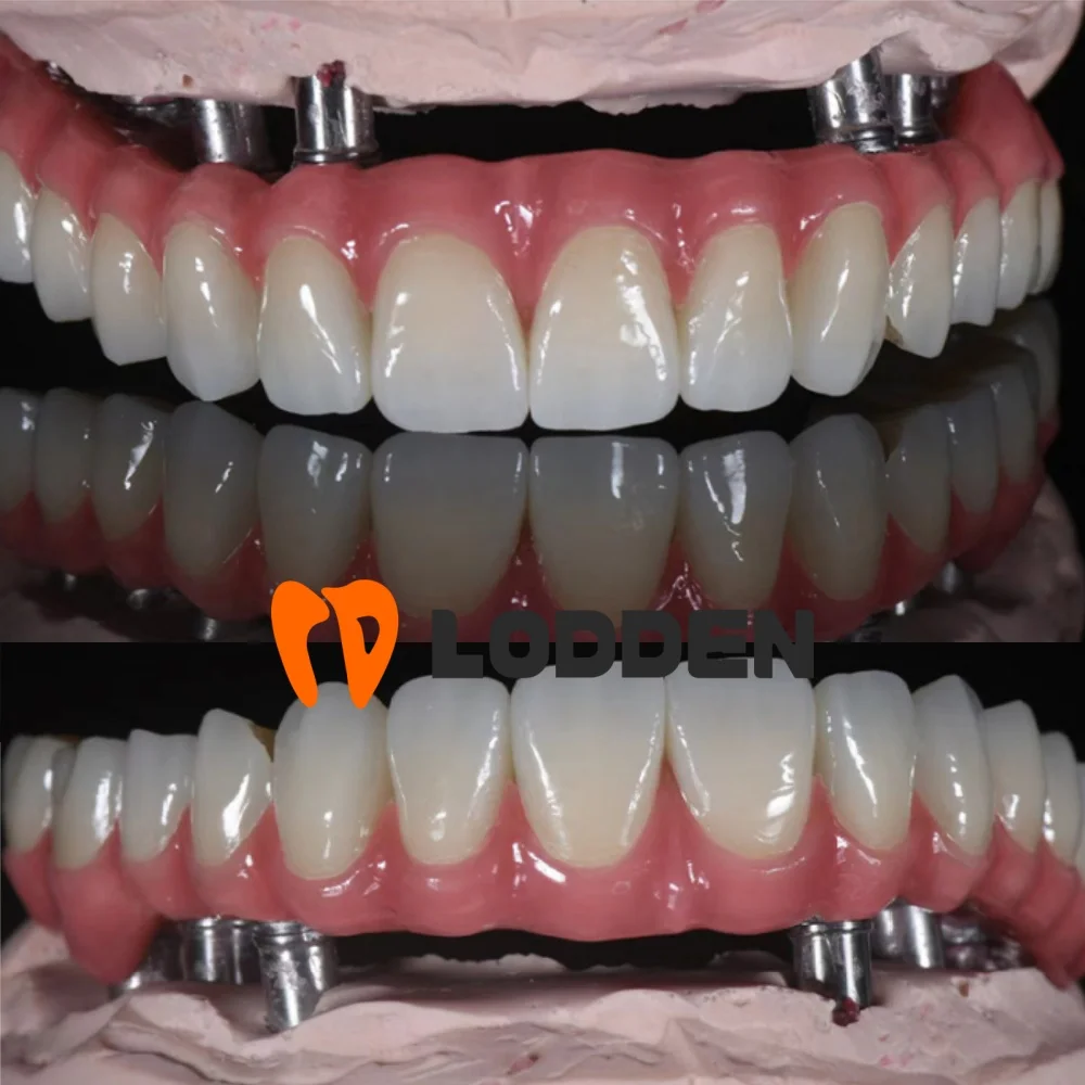 Lodden Dental Zirconia Block 4D PRO متعدد الطبقات لمواد مختبر CAD CAM نظام مفتوح 43%-57% قوة 700-1200Mpa Sinocera