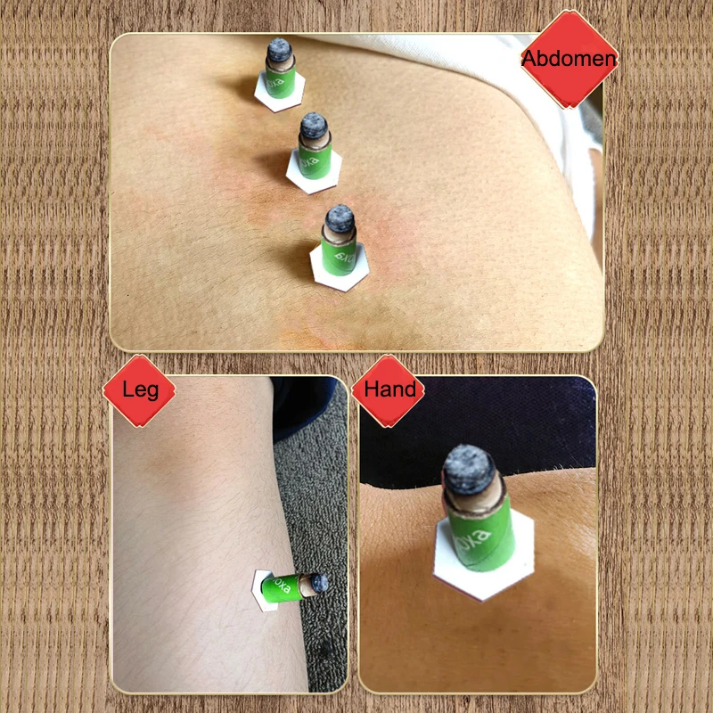 98Pcs Upgrades Temperature Controllable Mini Moxa Stickers Moxibustion Therapy Natural Ingredient Warm Meridians Acupoints