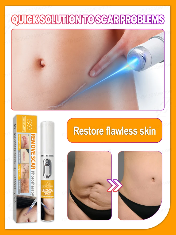 Sin cicatrices, piel lisa.