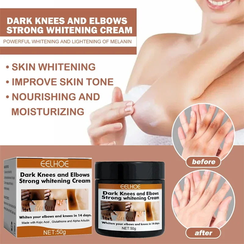 Body Whitening Cream Private Parts Underarm Bleaching Serum Whiten Butt Knee Brighten Inner Thigh Intimate Dark Remove Melanin