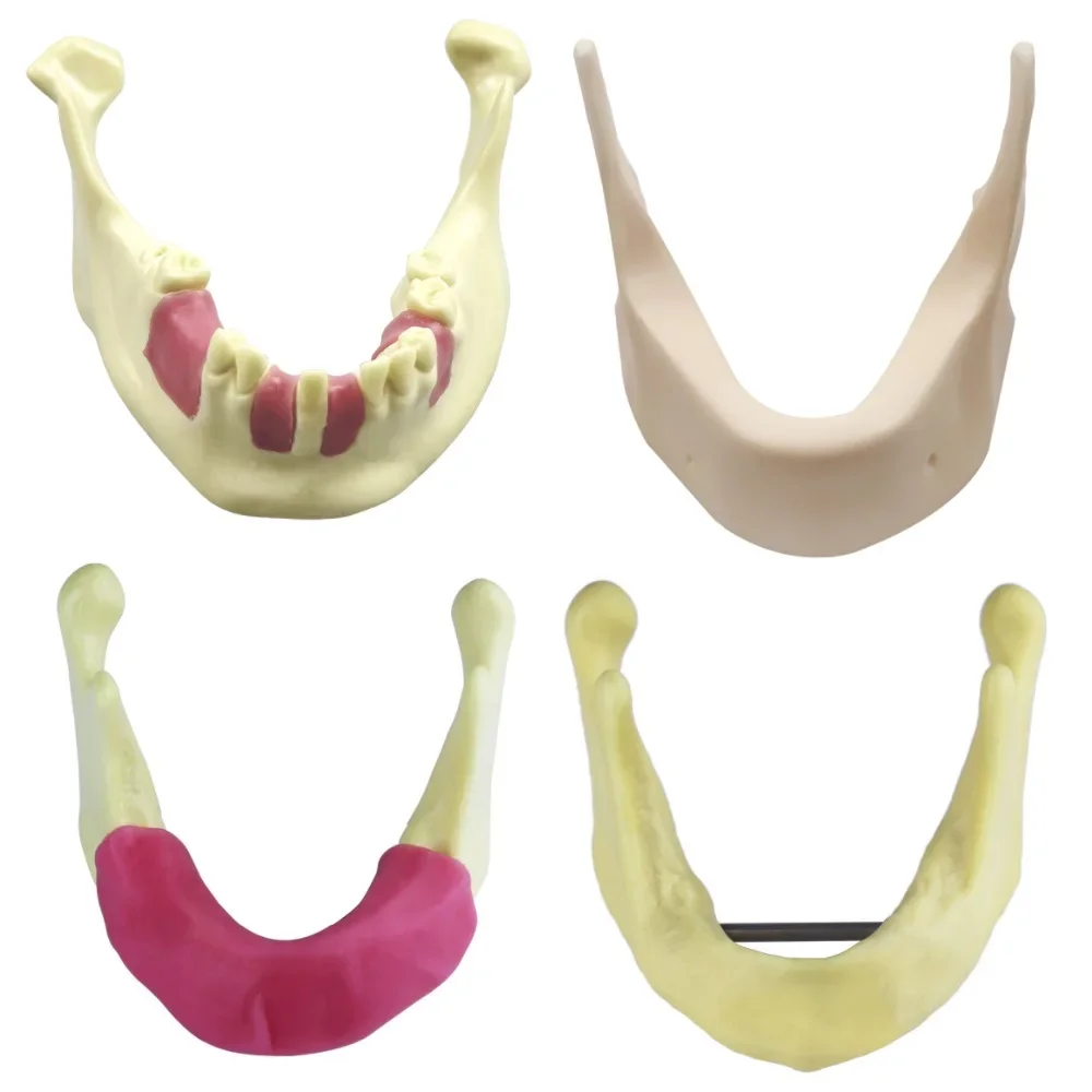Dental Model Implant Practice Teeth Teaching Model Mandible Train Education Demonstration Tool Lower Jaw Bone Simulation Model
