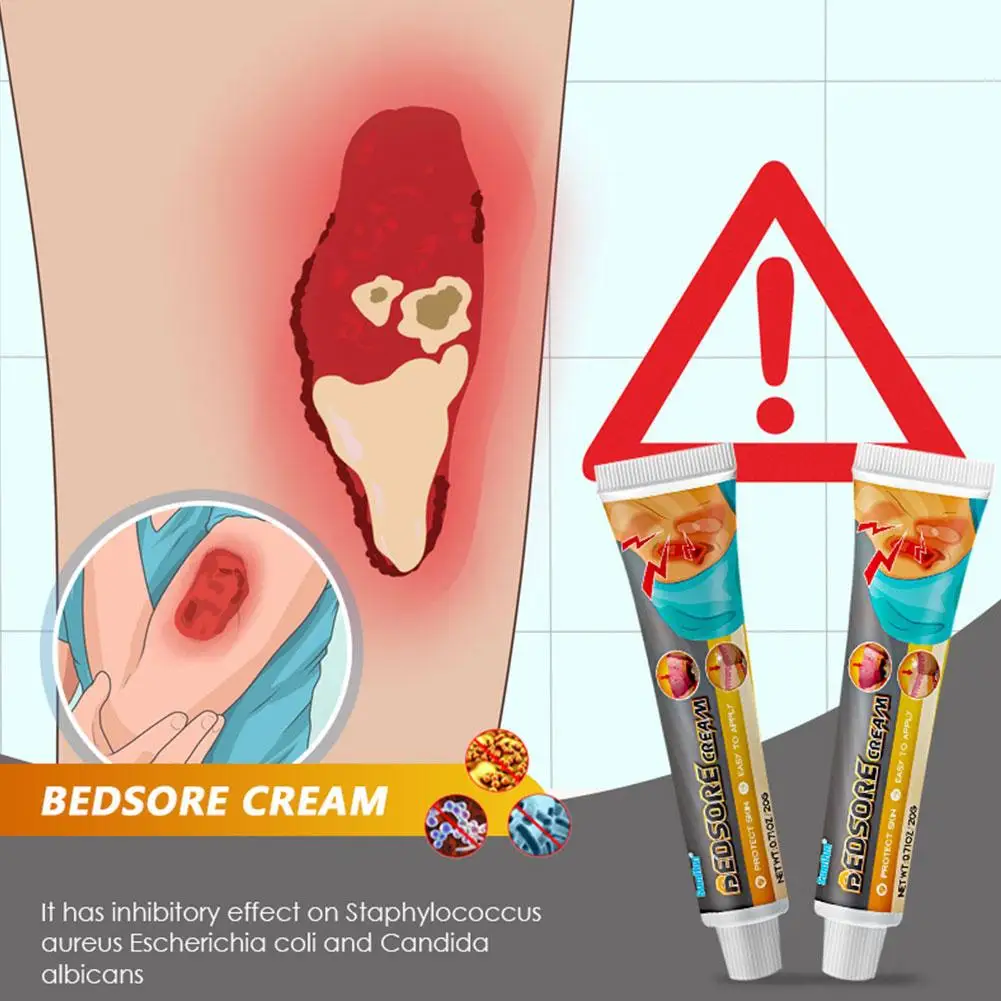 Bedsores Cream Healing Wound Plasters Treat Pressure Sores Ulcer Festering Necrotic Remove Rots Myogenic Pressure Ulcer Cream Ne