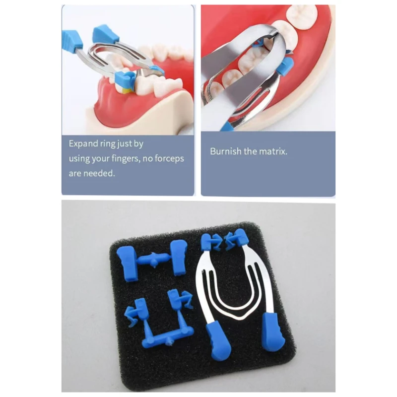 

Dental Sectional Contoured Metal Spring Clip Teeth Replacement Dentist Matrix Ring ToolsClip Matrices Clamps Wedges A&B