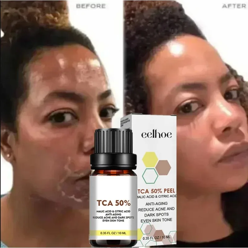 Рисунок 3 - Пилинг для лица с салициловой кислотой