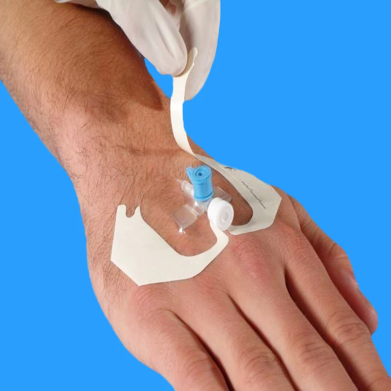 

Medical Disposable Breathable Transparent IV Cannula Fixed