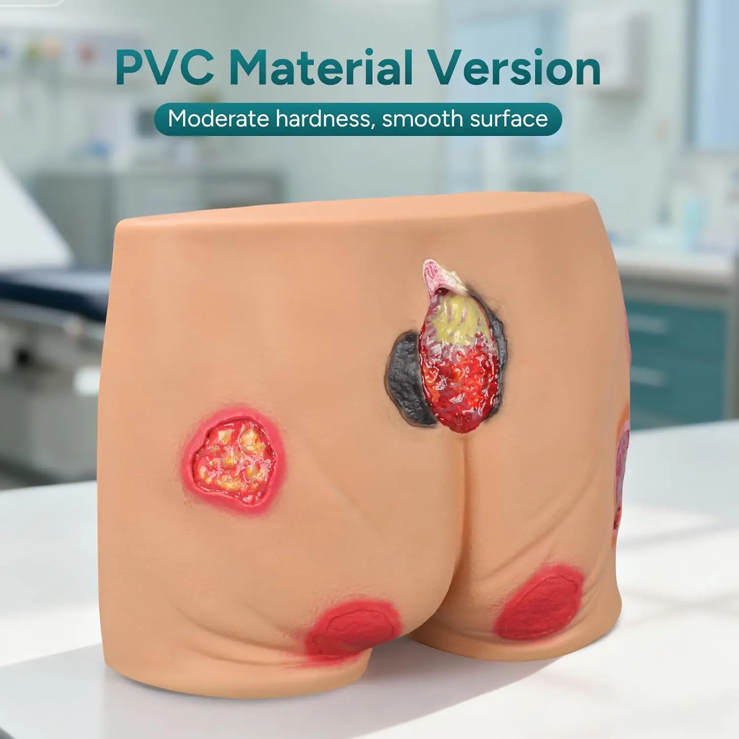 Ultrassist PVC Buttock Decubitus Ulcer Model Pressure Ulcer Wound Care Model Wound Care Education Tools for Medical Teaching