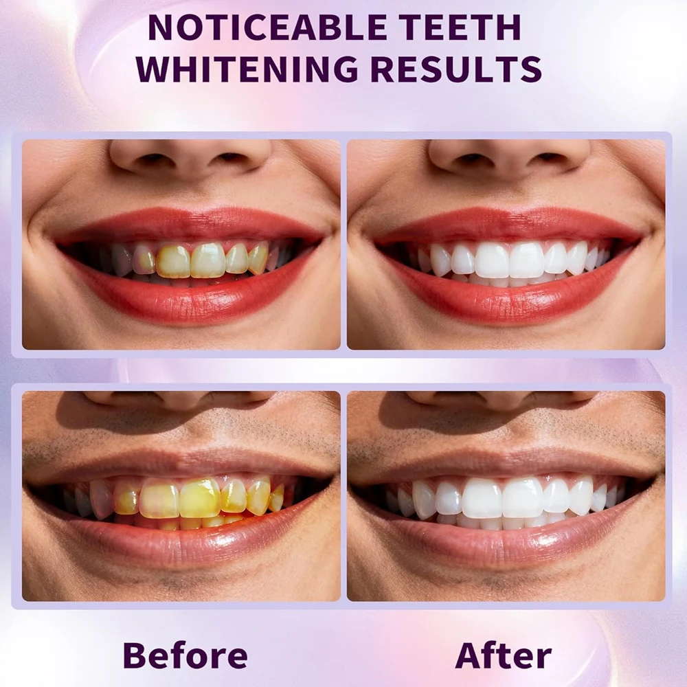 

Purple Teeth Whitening Strip No Sensitive Teeth Bleaching Strip Colour Corrector Instant Teeth Clean Strip,At-Home Teeth Whiter