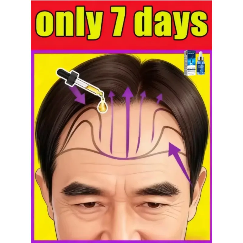 

Аппликатор-массажер для кожи головы, для стимуляции роста волос, расческа-дозатор для жидкостей, массажный инструмент, Хит продаж.