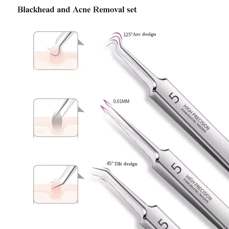 4/5 PCS rimozione di punti neri Comedones Extractor Kit di rimozione dell'acne per Blemish Whitehead Popping Zit rimozione per strumenti viso naso