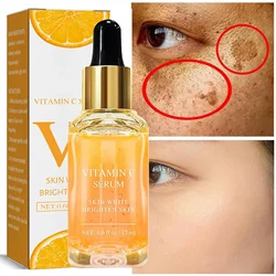 Vitamin C Remove Dark Spots Serum Whitening Freckles Fade Melanin Brightening Skin Tone