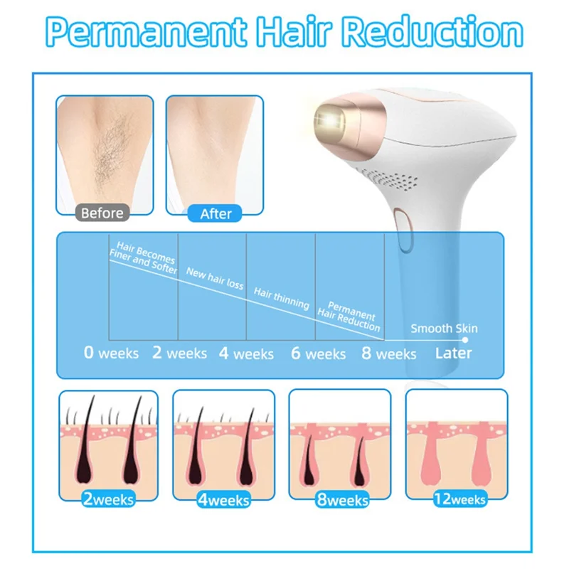 جهاز إزالة الشعر بنقطة التجمد، جهاز إزالة الشعر المحمول باليد، جهاز إزالة الشعر المنزلي غير المؤلم، قابس الاتحاد الأوروبي