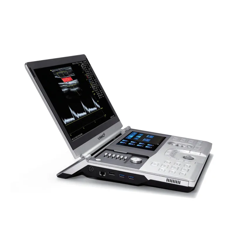 VINNO 6 Medical Ultrasound ultrasonic Instruments, Portable Color Doppler 4D Ultrasound Machine