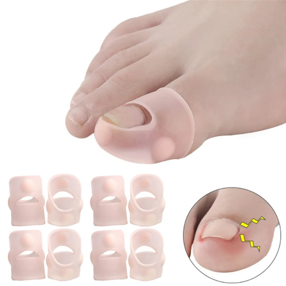 1 Par Gel Engrown Toenail Corrector Mangas Big Toe Nail Healing Care Protector Paroníquia Pain Relief Tratamento Pedicure Ferramenta