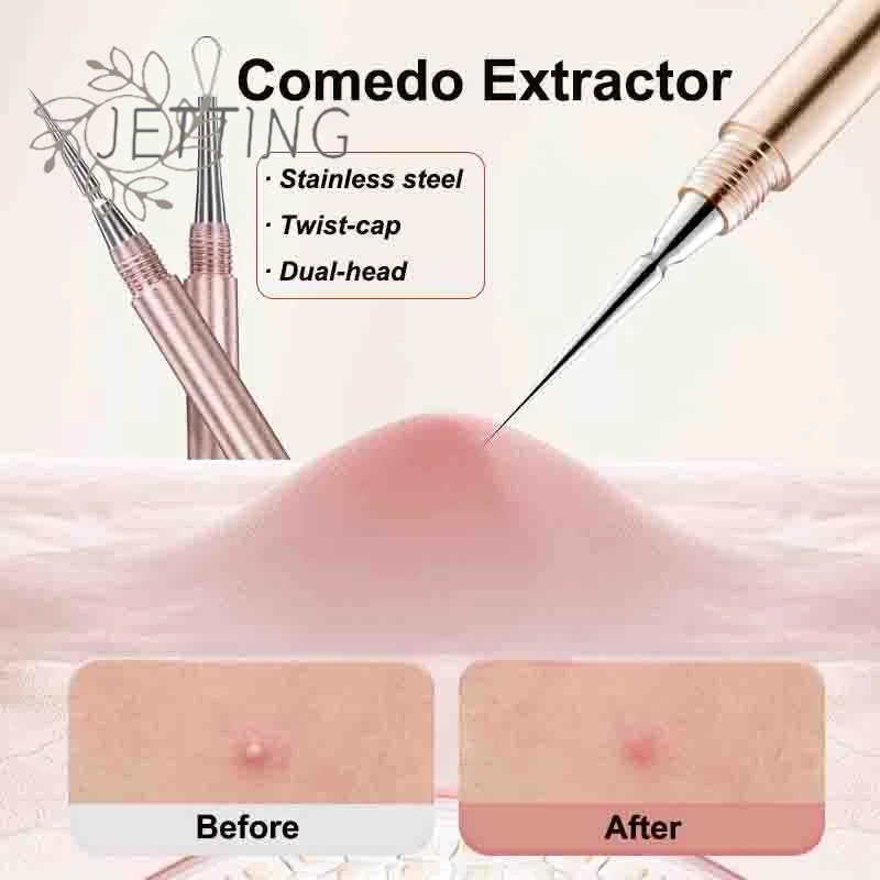 Hot 1Pc Mitesser Komedonen Akne Pickel Blemish Extractor Remover Edelstahl Nadel Entfernen Werkzeuge Gesicht Hautpflege Poren Reiniger