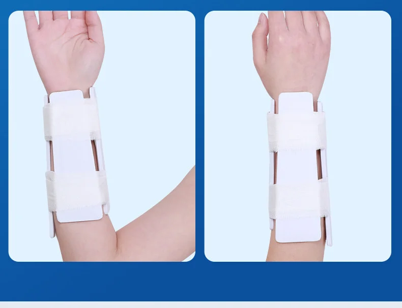 Medical polymer splint for distal radius fracture fixation, arm fracture, thigh fracture, plastic splint fixation brace