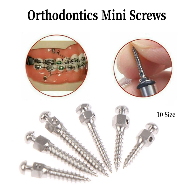 

Стоматологический мини-винт из титанового сплава, ортодонтический инструмент для стоматолога