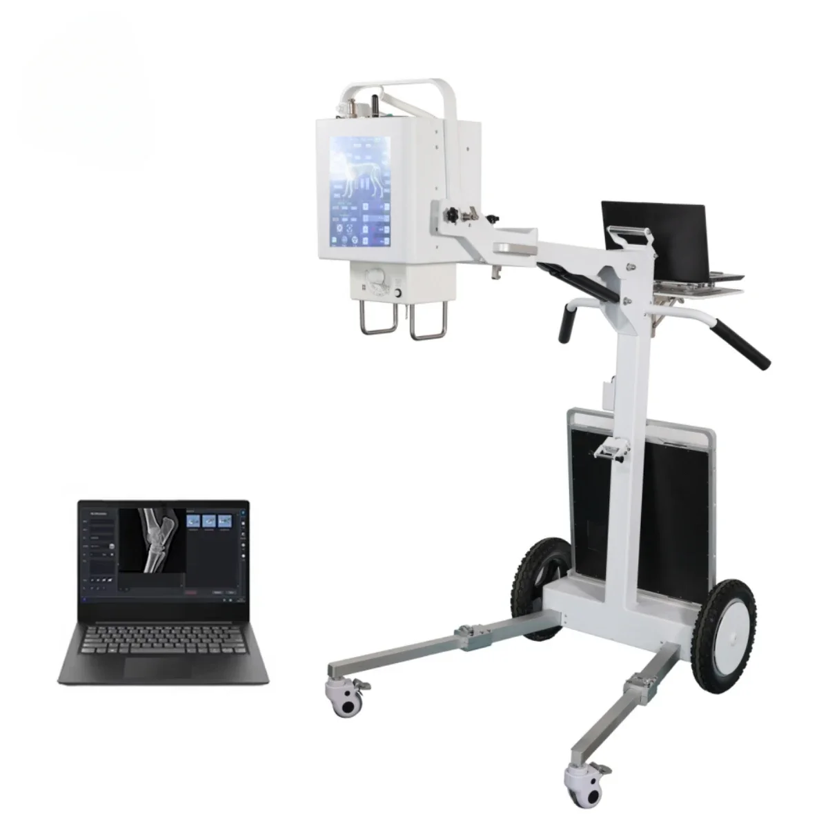 High Frequency Radiography 100MA Xray System Medical Diagnostic X-ray Equipment Mobile X Ray Machine Price with DR