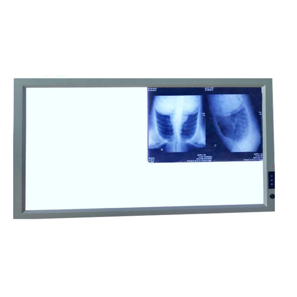 2026 Negatoscope Price X Ray Film Medical Union Led Professional Film Viewer den-tal Hospital Scanner Box Double X-Ray Film View