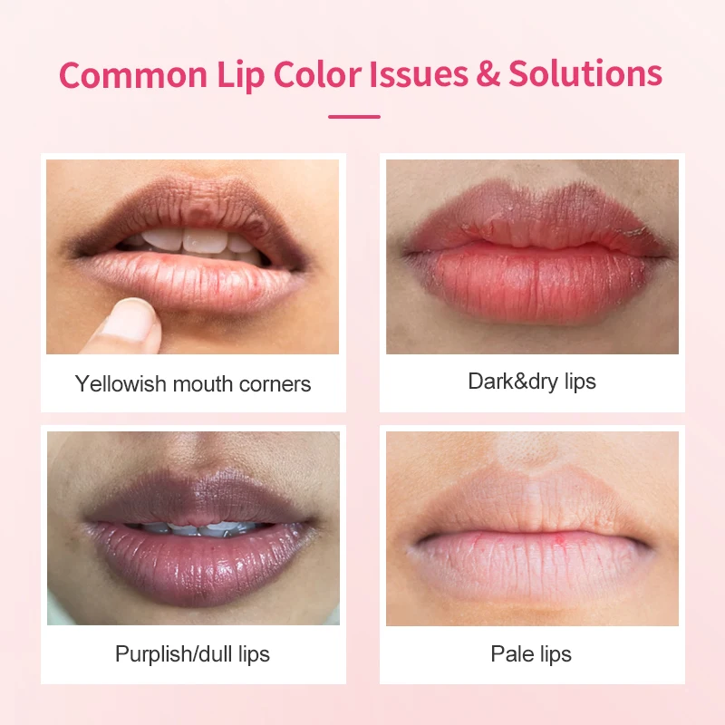 リップグロス Roma Pink Lip Repair Cream Roma Pink Lip Repair Cream: A Deep Dive into Real Results for