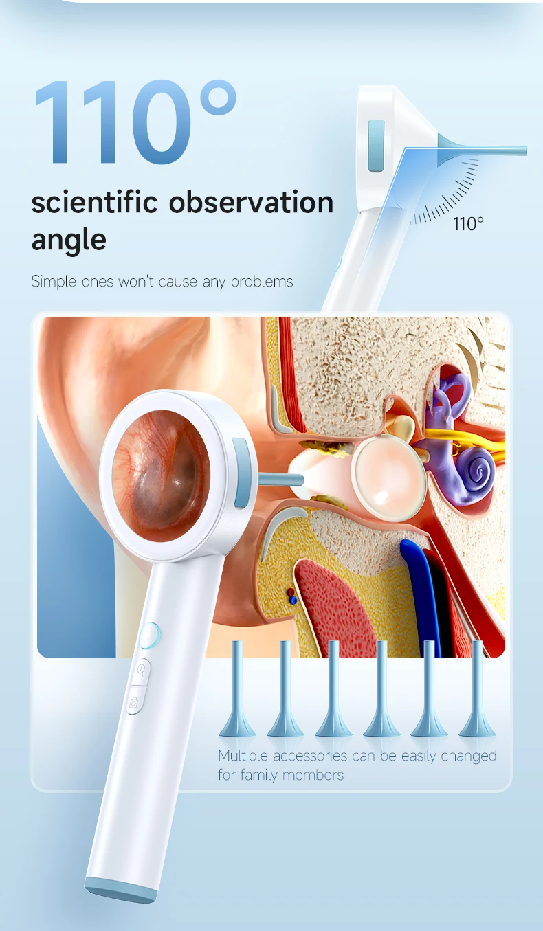 Ear Cleaner Camera with Screen 1080P Otoscope Ear Wax Removal Tool for Kids Adults & Pets 1.8’’ Screen LED Light Safe Ear Picker
