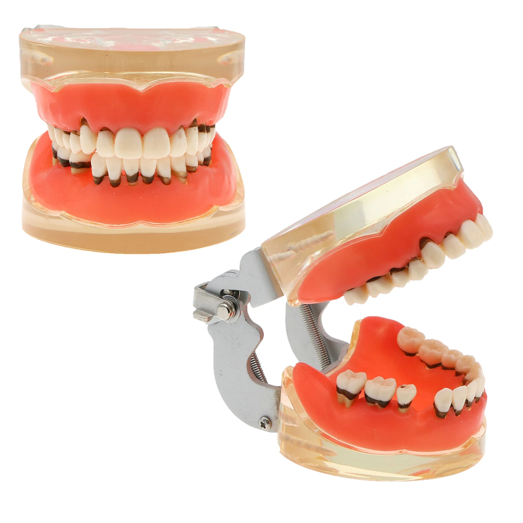 Dental Model Periodontal Disease Pathological for Teaching Gingivae Can Replacment  Dentistry Educational Models