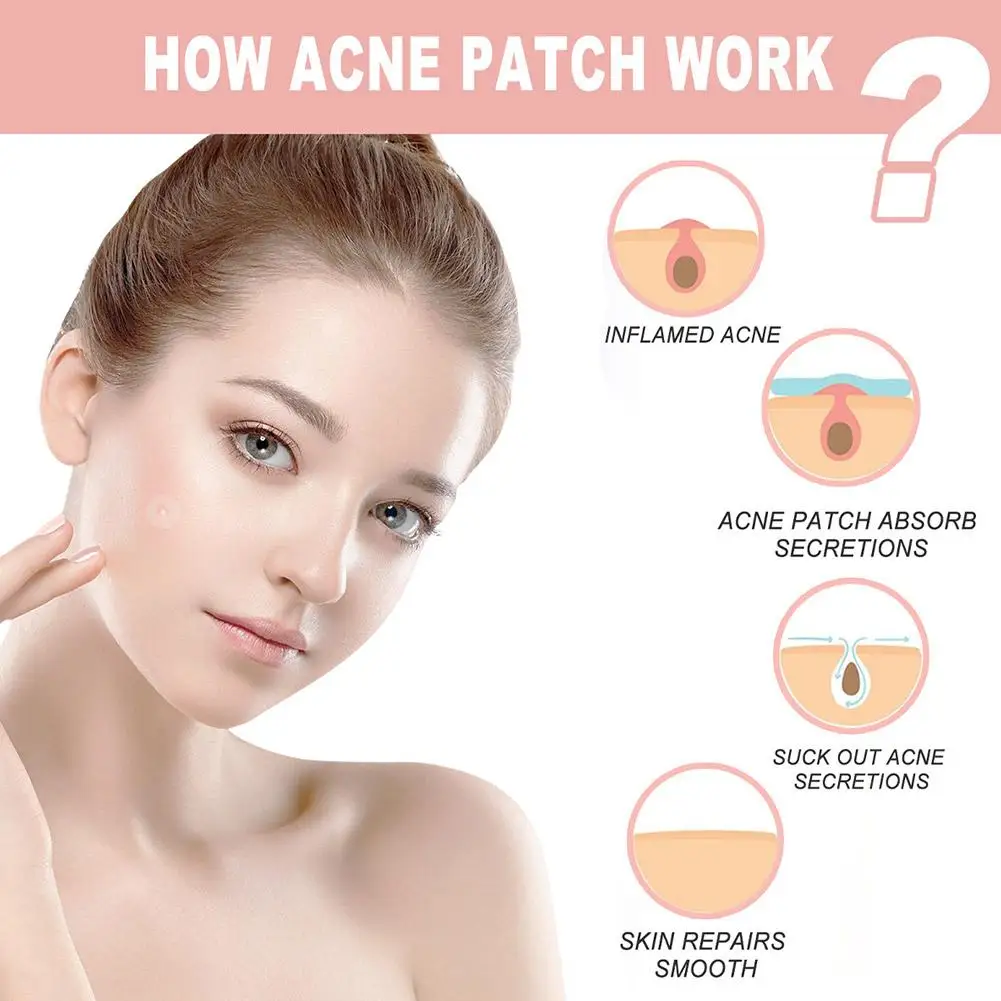 Patch Acne Pimple Patch Stickers Day Night Use Hydrocolloid Blackhead Blemish Removers Beauty Face Skin Care