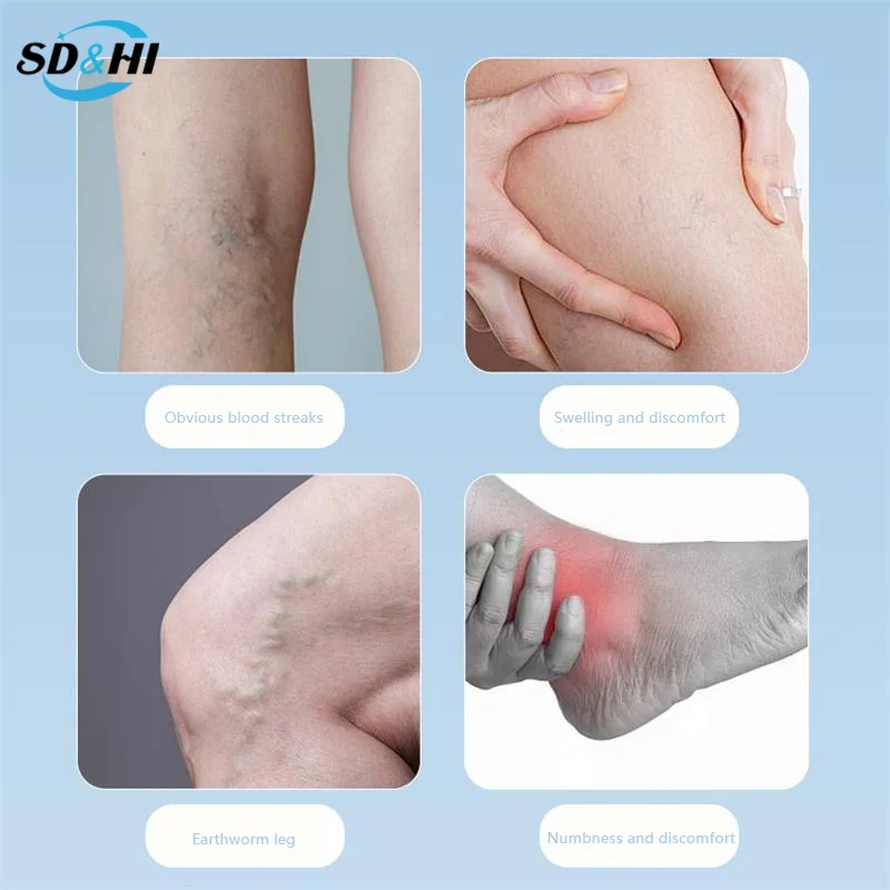 10Pcs Plaster Varicose Veins Patch Treatment Spider Leg Varicose Veins Vasculitis Phlebitis Red Blood Vein Patches Medical Patch