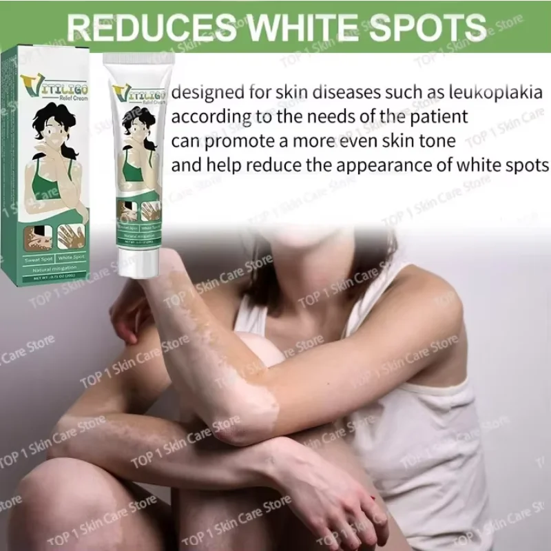 

Improve Skin Pigmentation and Reduce White Spots Vitiligo Treatment 0903