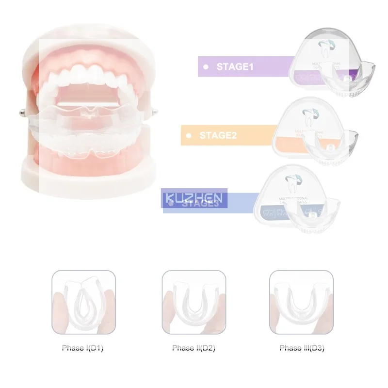 /Kuz/Braces Dental Braces Smile Teeth Alignment Trainer Instanted Silicone Teeth Retainer Mouth Guard Braces Tooth Tray