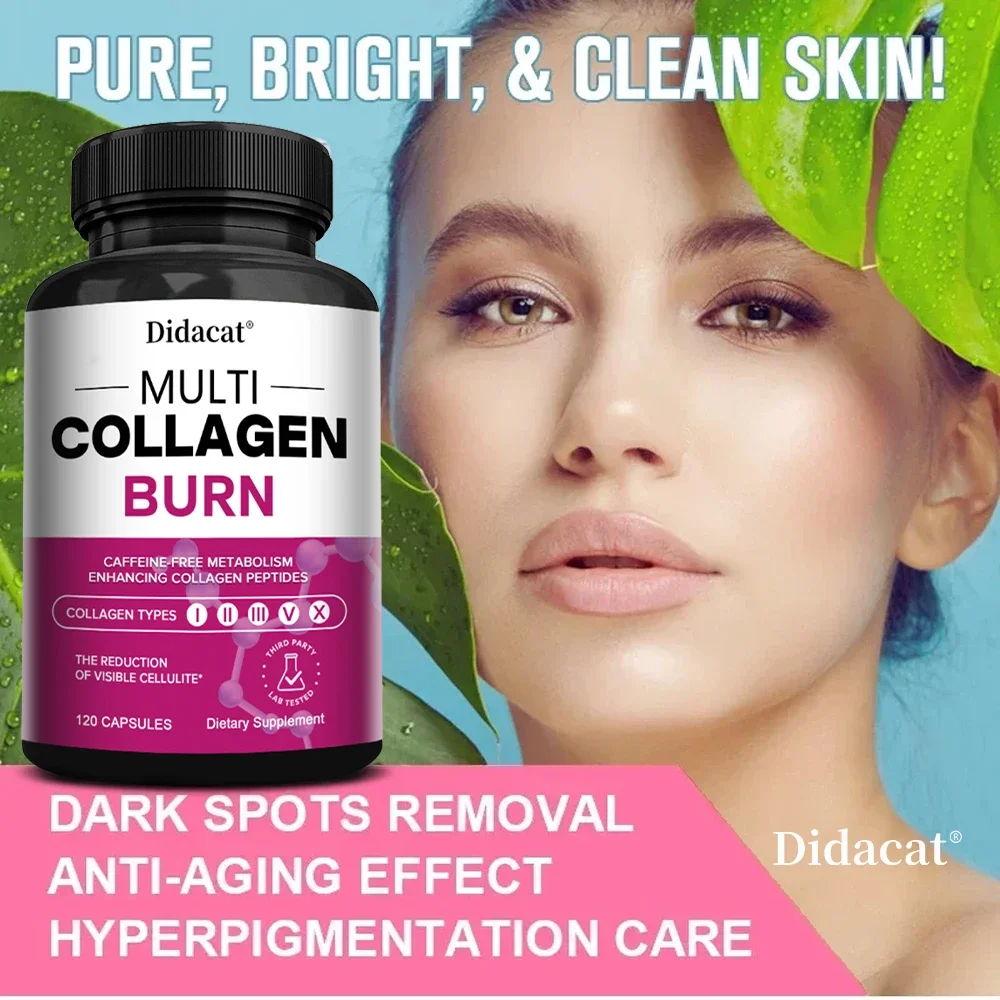 Multi-Collagen Burn - Helps Boost Metabolism, Burn Fat, Support Healthy Hair, Nails, Skin, Teeth and Gums - Collagen Peptides