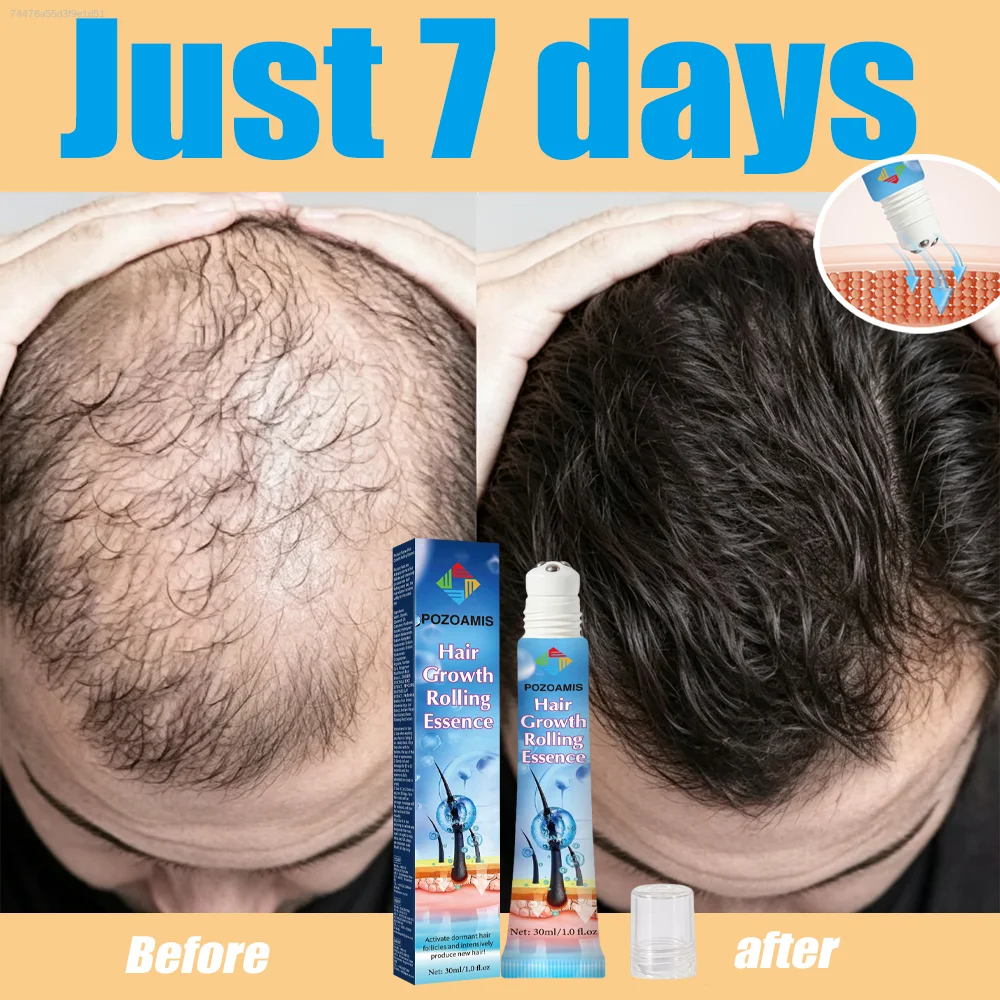 No need to apply with your hands! The roll-on design makes nourishing hair roots super convenient.