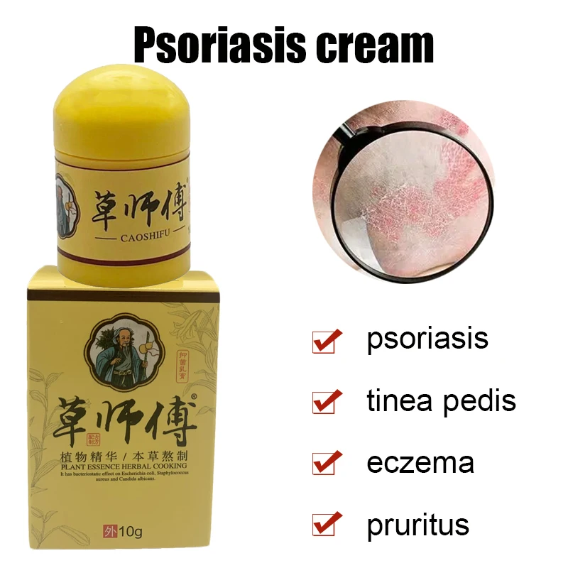 

4pcs 10g Natural Psoriasis Ointment Treat Dermatitis Eczema Antipruritic Dressing Eczematoid Skin Repair Antibacterial Cream