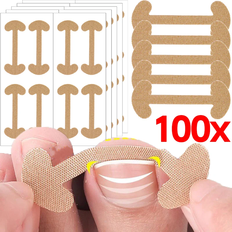 20-100pcs Adhesive Toenail Patch Ingrown Toe Nail Correction Sticker Foot Corrector Pedicure Health Care Tools Toe Treatment Pad